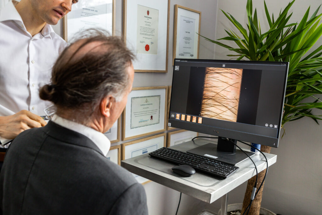 Hudlege som viser pasientens hår på skjerm før behandling.